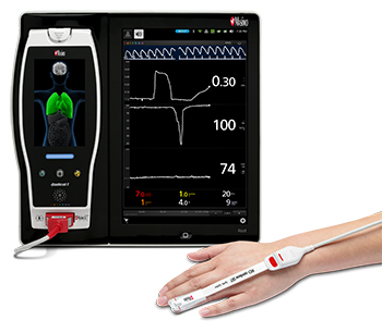 Masimo Root with Radical-7, ORi, and the RD rainbow SET Sensor