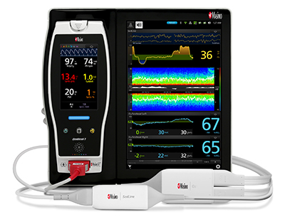 Masimo Root with SedLine PSi and O3 Regional Oximetry