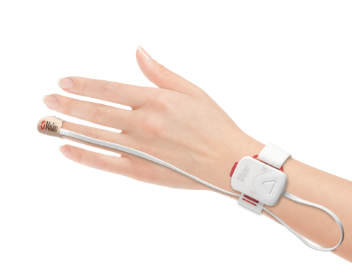 Masimo SedLine® Brain Function Monitoring