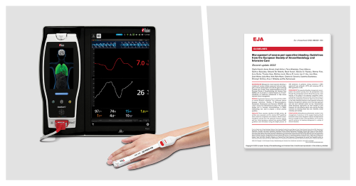 Masimo Root® with PVi®