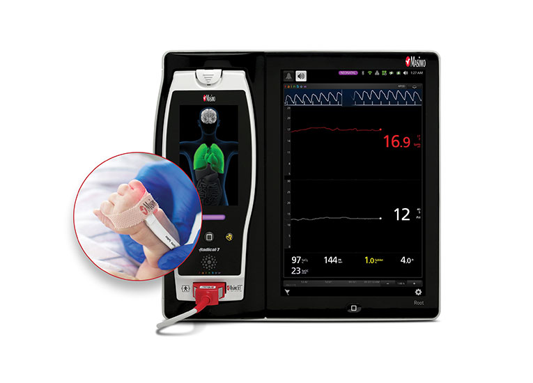 Masimo - Placing sensor on baby arm in hospital 