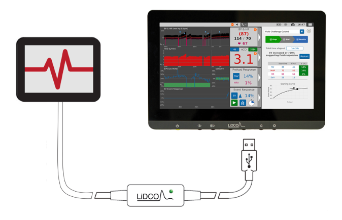 LiDCO Monitor with cord linking to reader