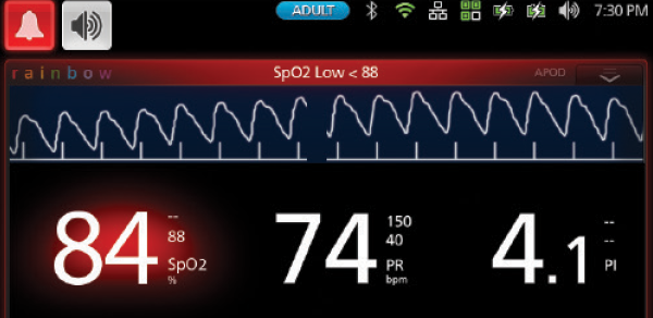 Masimo - Alarms on Rad-97