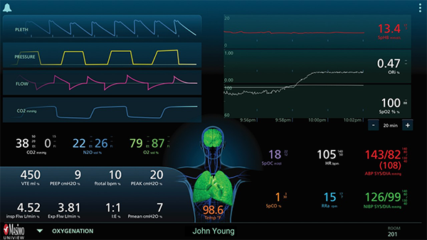 Masimo - UniView - Oxygenation Layout