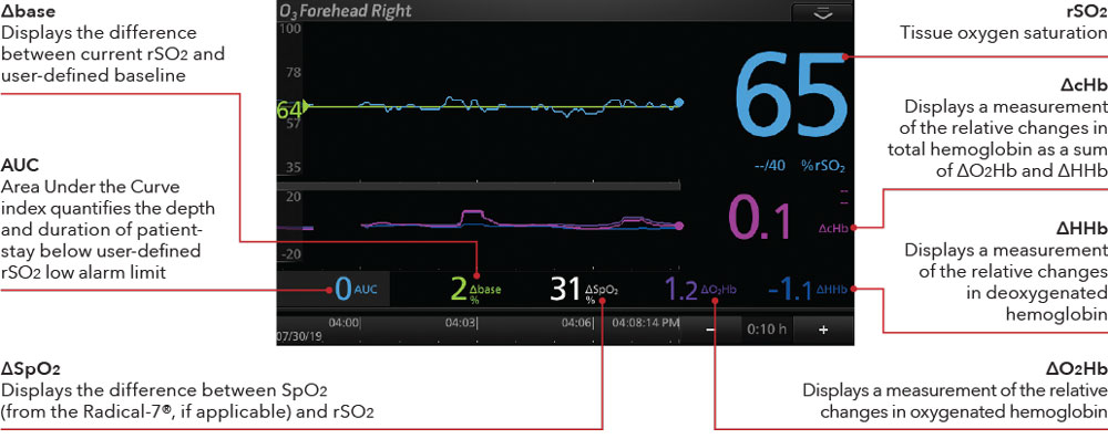 Masimo - O3 Display Cerebral Oximetry